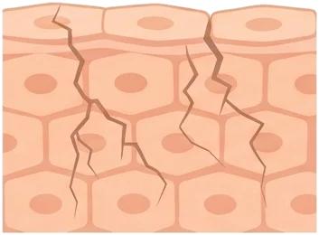 Comment savoir si votre peau manque de céramides ?